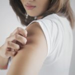 Woman scratching her arm.