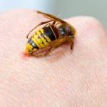Wasp Sting