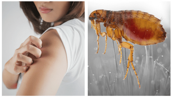 Is that a Flea Bite? Identifying & Treating Flea Bites